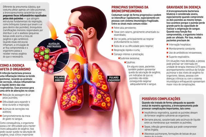 Quadro de Bolsonaro é grave